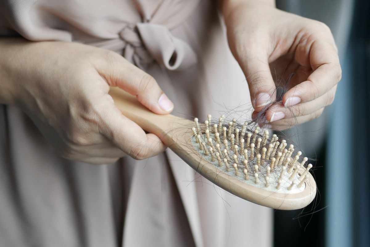 Why Is My Hair Falling Out? The Blood Tests That May Reveal the Cause